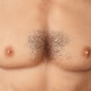 胸の毛植毛[+5,000円]